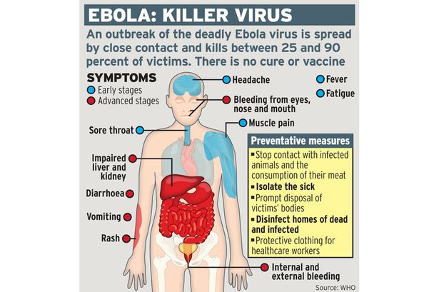 BITU URGES READINESS FOR AND PREVENTION OF EBOLA VIRUS IN JAMAICA